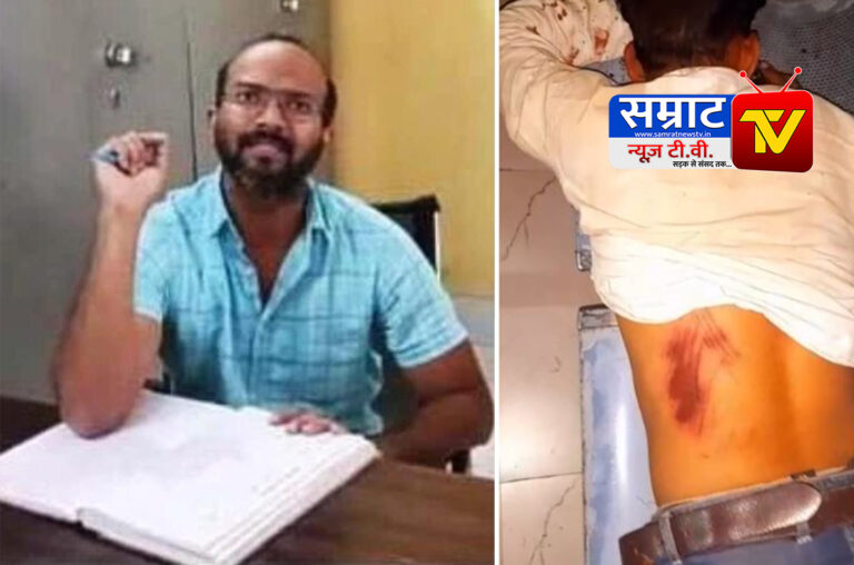 Jalaun News: माधौगढ़ में इलाज के लिए पहुंचे पत्रकार से हुई मारपीट हड्डी पसली तोड़ डाली, हालत नाजुक झांसी रेफर