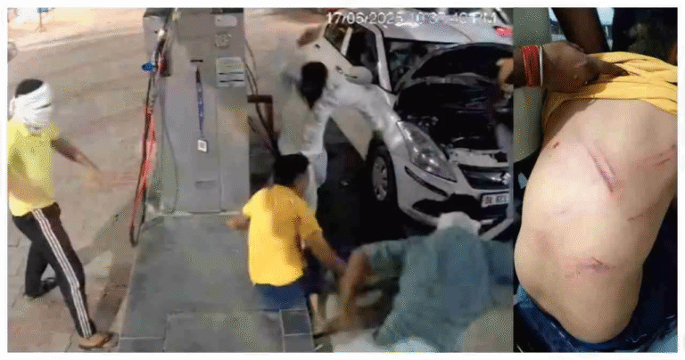 CNG pump employee brutally beaten by masked men
