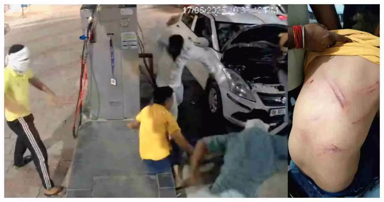 CNG pump employee brutally beaten by masked men