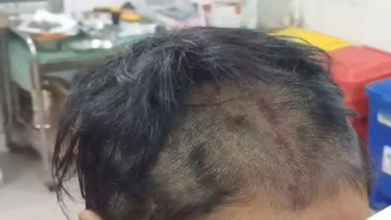 Firozabad News: पति की दरिंदगी, पत्नी को 3 घंटे बंधक बनाकर पीटा, बाल काटकर सड़क किनारे फेंका